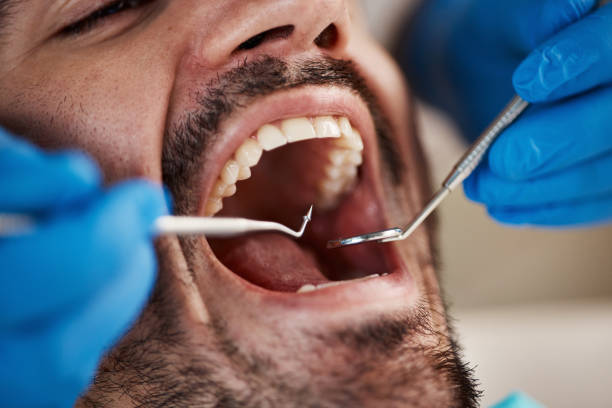 Best Emergency Gum Treatment in Mocksville, NC